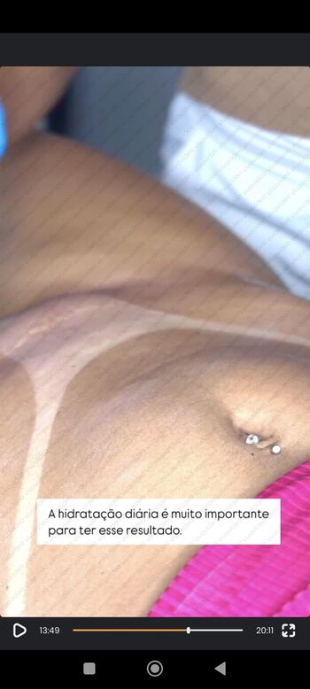 Bronzeamento Natural