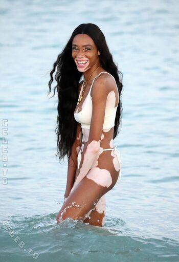Winnie Harlow